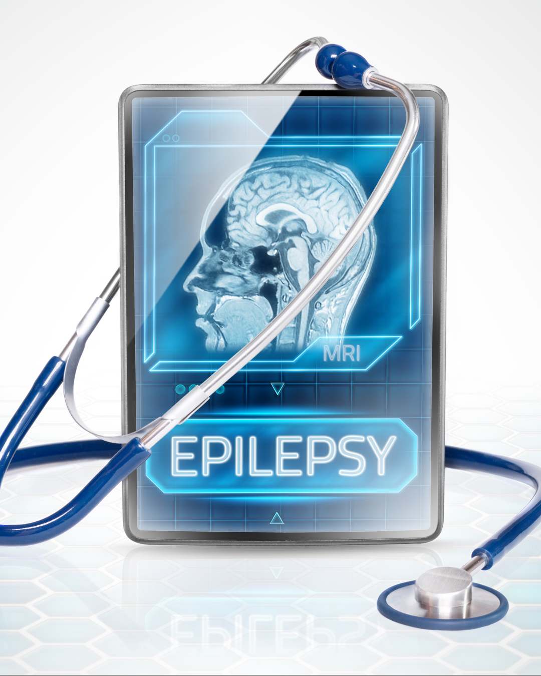 Epilepsy
